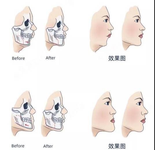 牙颌面畸形