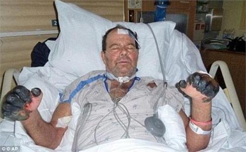 对于勐海发现1例疑似腺鼠疫病例,这种病毒有治疗方法吗?