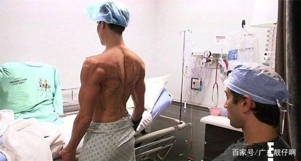 很多年前，男子给自己的后背上安上了一双翅膀，现在状况如何？