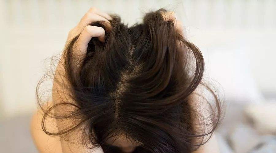 头发出油快的原因和控油的办法是什么？