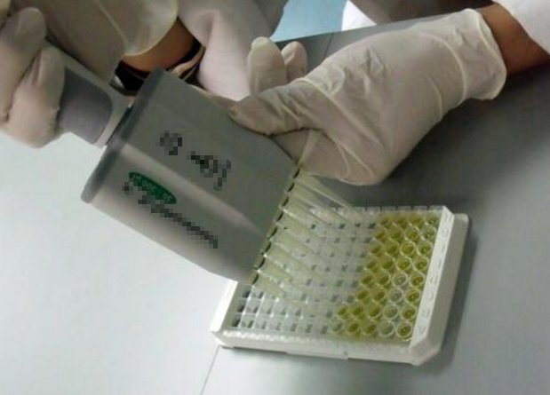 想去做过敏原检查，一般多少钱啊？