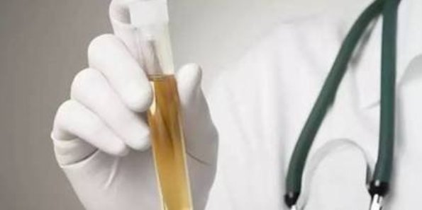 肾糖阈的名词解释