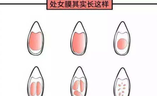 小学生破苞出血是什么情况？