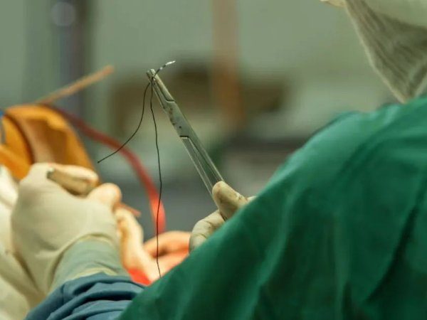 柳叶刀是什么意思