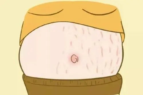 广东一孕妈分享妊娠纹视频，引起热议，你觉得妊娠纹镜头该被剪掉吗？