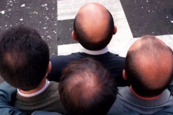 莫言现场回答网友提问脱发问题，你身边的朋友是否出现了脱发的迹象？