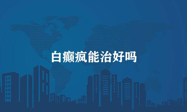 白癫疯能治好吗